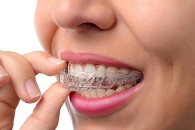 First Global Clinic -Invisalign