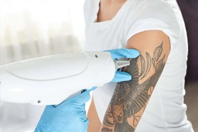 First Global Clinic -Laser Tattoo Removal